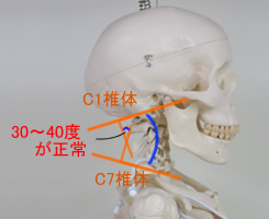 首が痛くなるのは歩きスマホのせい