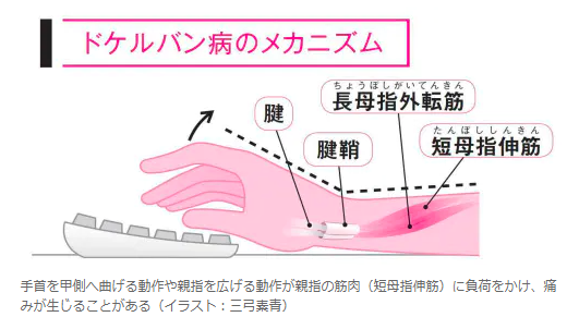 スマホの使い過ぎで手首や指に電気が走ったら。