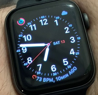 AppleWatchを数分速く設定する方法
